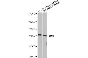 Western blot analysis of extracts of various cell lines, using CA9 Antibody.