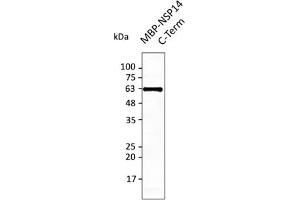Western Blotting (WB) image for anti-SARS-CoV-2 Guanine-N7 Methyltransferase (NSP14) (ExoN) (C-Term) antibody (ABIN7273006) (SARS-CoV-2 NSP14 antibody  (C-Term))