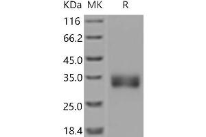 Western Blotting (WB) image for Sclerostin (SOST) protein (His tag) (ABIN7197841) (Sclerostin Protein (SOST) (His tag))