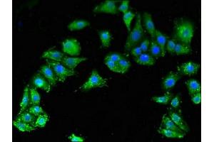 Immunofluorescent analysis of HepG2 cells using ABIN7171024 at dilution of 1:100 and Alexa Fluor 488-congugated AffiniPure Goat Anti-Rabbit IgG(H+L) (SMN1 antibody  (AA 3-194))