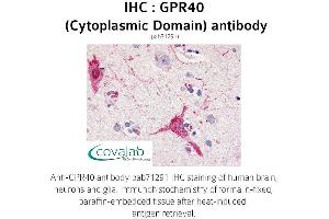 Image no. 1 for anti-Free Fatty Acid Receptor 1 (FFAR1) (1st Cytoplasmic Domain) antibody (ABIN1735088) (FFAR1 antibody  (1st Cytoplasmic Domain))
