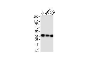 Western blot analysis of extracts from JK cells (Lane 1), K562 cells (Lane 2) and 293 cells (Lane 3), using ANXA1 (Ab-21) Antibody.