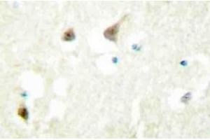 Immunohistochemistry (IHC) analyzes of hnRNP C1/C2 antibody in paraffin-embedded human brain tissue. (HNRNPC antibody)