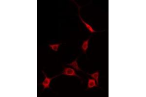 ABIN6275119 staining A549 by IF/ICC. (EIF2AK1 antibody  (C-Term))