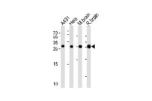 Western blot analysis in A431,Hela cell line,mouse brain and rat brain lysates (35ug/lane).