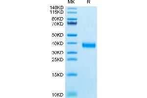 SARS-CoV-2 Spike RBD (Gamma P. (SARS-CoV-2 Spike Protein (P.1 - gamma, RBD) (His tag))