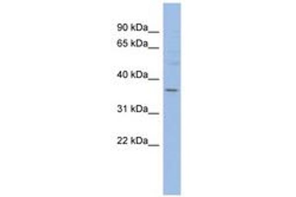 HMGCLL1 antibody  (N-Term)
