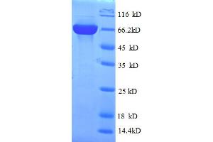 SDS-PAGE (SDS) image for Phospholipase D Family, Member 5 (PLD5) (AA 92-536) protein (His-SUMO Tag) (ABIN5711569)