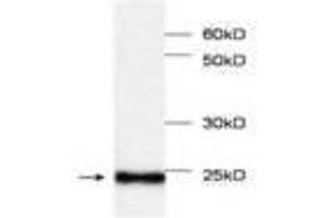 Image no. 1 for anti-Myoglobin (MB) antibody (ABIN791534) (Myoglobin antibody)