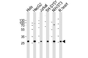 Western blot analysis of lysates from Hela, HepG2, Jurkat, SH-SY5Y, mouse NIH/3T3 cell line and rat heart tissue lysate(from left to right), using VB Antibody (Center) 20627c. (VAPB antibody  (AA 126-139))