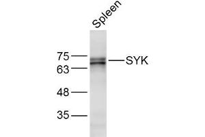 Mouse Spleen lysates probed with SYK Polyclonal Antibody, Unconjugated  at 1:300 dilution and 4˚C overnight incubation. (SYK antibody  (AA 501-600))