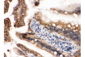 IHC analysis of GTPase HRAS using anti-GTPase HRAS antibody (ABIN3043845).