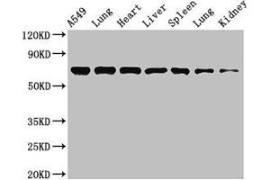 Western Blot Positive WB detected in: A549 whole cell lysate, Rat lung tissue, Mouse heart tissue, Mouse liver tissue, Mouse spleen tissue, Mouse lung tissue, Mouse kidney tissue All lanes: RPA1 antibody at 3. (RPA1 antibody  (AA 2-616))