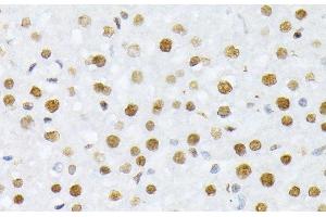Immunohistochemistry of paraffin-embedded Rat liver using Phospho-Histone H2A(S129) Polyclonal Antibody at dilution of 1:100 (40x lens). (Histone H2A antibody  (pSer129))