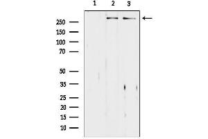 Western blot analysis of lysates from various samples, using ASPM Antibody.