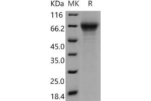 Western Blotting (WB) image for Thrombospondin, Type I, Domain Containing 1 (THSD1) protein (His tag) (ABIN7320290)