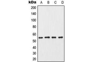 Western blot analysis of CK1 gamma 3 expression in HeLa (A), mouse testis (B), rat testis (C), PC12 (D) whole cell lysates.