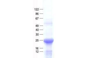 Splicing factor U2AF 26 kDa subunit (U2AF1L4) protein (His tag)