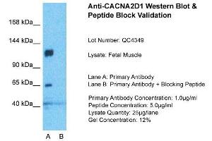Host:  Rabbit  Target Name:  CACNA2D1  Sample Type:  Fetal Muscle  Lane A:  Primary Antibody  Lane B:  Primary Antibody + Blocking Peptide  Primary Antibody Concentration:  1ug/ml  Peptide Concentration:  5ug/ml  Lysate Quantity:  25ug/lane/Lane  Gel Concentration:  0. (CACNA2D1 antibody  (Middle Region))