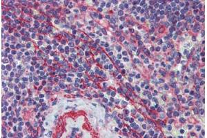 Spleen, Human: Formalin-Fixed, Paraffin-Embedded (FFPE) (MCTP1 antibody  (C-Term))