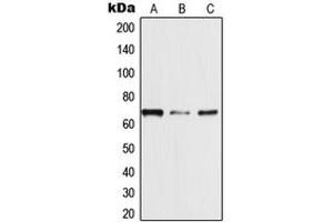 Western blot analysis of TRAF3IP3 expression in MDAMB453 (A), Jurkat (B), HeLa (C) whole cell lysates. (TRAF3IP3 antibody  (Center))