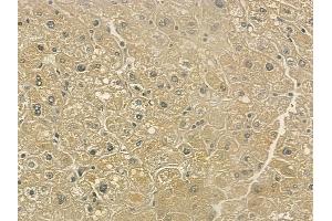 ABIN6261040 and ABIN6273217 at 1/100 staining human normal liver tissue by IHC-P. (CRLS1 antibody  (Internal Region))