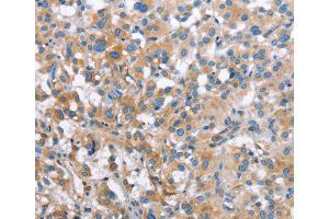 Immunohistochemistry (IHC) image for anti-Induced Myeloid Leukemia Cell Differentiation Protein Mcl-1 (MCL1) antibody (ABIN2434307) (MCL-1 antibody)