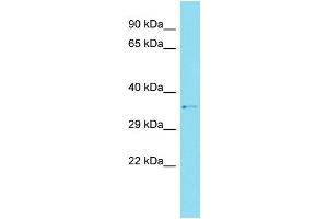 Host: Rabbit Target Name: CCDC159 Sample Type: Hela Whole cell lysates Antibody Dilution: 1. (CCDC159 antibody  (C-Term))