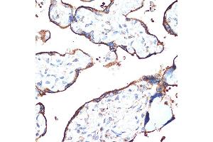 Immunohistochemistry of paraffin-embedded human placenta using CYPOR Rabbit mAb (ABIN7269151) at dilution of 1:100 (40x lens). (POR antibody)