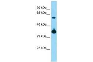 Image no. 1 for anti-BMI1 Polycomb Ring Finger Oncogene (BMI1) (AA 181-230) antibody (ABIN6748382) (BMI1 antibody  (AA 181-230))