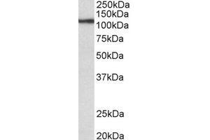 Western Blotting (WB) image for anti-Thyroid Peroxidase (TPO) (Internal Region) antibody (ABIN2464949) (Thyroperoxidase antibody  (Internal Region))