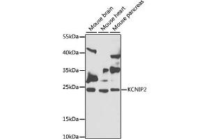 Western blot analysis of extracts of various cell lines, using KCNIP2 antibody (ABIN6128150, ABIN6142713, ABIN6142714 and ABIN6222906) at 1:1000 dilution. (KCNIP2 antibody  (AA 1-90))