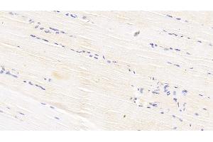 Detection of APOB100 in Bovine Skeletal muscle Tissue using Polyclonal Antibody to Apolipoprotein B100 (APOB100) (Apo-B100 antibody  (AA 4331-4567))