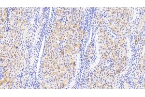 Detection of DDC in Human Kidney Tissue using Polyclonal Antibody to Dopa Decarboxylase (DDC) (DDC antibody  (AA 200-420))