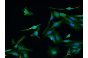 Immunofluorescence of purified MaxPab antibody to PSME1 on HeLa cell. (PSME1 antibody  (AA 1-249))