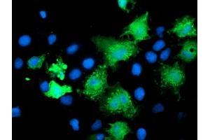 Anti-KATNB1 mouse monoclonal antibody (ABIN2455186) immunofluorescent staining of COS7 cells transiently transfected by pCMV6-ENTRY KATNB1 (RC201852). (KATNB1 antibody)