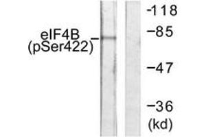 Western blot analysis of extracts from NIH-3T3 cells, using eIF4B (Phospho-Ser422) Antibody. (EIF4B antibody  (pSer422))
