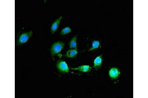 Immunofluorescent analysis of A549 cells using ABIN7144455 at dilution of 1:100 and Alexa Fluor 488-congugated AffiniPure Goat Anti-Rabbit IgG(H+L) (Bcl-2 antibody  (AA 31-80))
