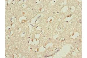 Immunohistochemistry of paraffin-embedded human brain tissue using ABIN7149271 at dilution of 1:100 (CYP4B1 antibody  (AA 30-250))