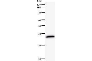Western Blotting (WB) image for anti-Nei Endonuclease VIII-Like 3 (NEIL3) antibody (ABIN931131) (NEIL3 antibody)