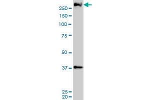 PARC monoclonal antibody (M01), clone 3F7 Western Blot analysis of PARC expression in A-431 (CUL9 antibody  (AA 918-1025))