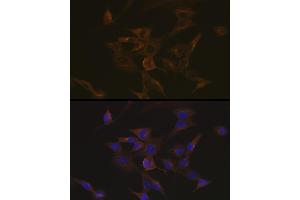 Immunofluorescence analysis of NIH-3T3 cells using EB3/M Rabbit mAb (ABIN7268535) at dilution of 1:100 (40x lens).