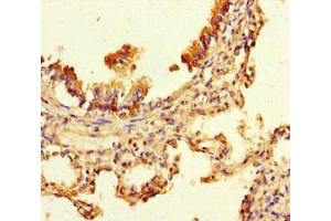 Immunohistochemistry of paraffin-embedded human lung tissue using ABIN7174595 at dilution of 1:100