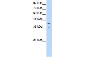 WB Suggested Anti-PCBP4 Antibody Titration:  1. (PCBP4 antibody  (Middle Region))
