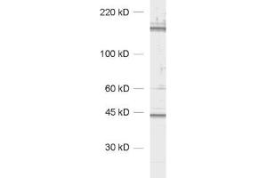 Western Blotting (WB) image for anti-CAP-GLY Domain Containing Linker Protein 1 (CLIP1) (AA 1283-1438) antibody (ABIN1742486) (CLIP1 antibody  (AA 1283-1438))