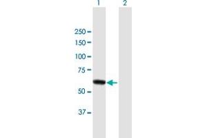 Western Blot analysis of DPYSL4 expression in transfected 293T cell line by DPYSL4 MaxPab polyclonal antibody.