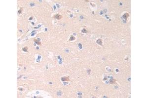 IHC-P analysis of brain tissue, with DAB staining. (Cathepsin W antibody  (AA 22-376))