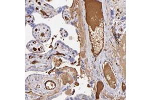 Immunohistochemical staining of human placenta with FGB polyclonal antibody  shows extracellular positivity in blood vessels and cytoplasmic positivity in trophoblastic cells. (Fibrinogen beta Chain antibody)