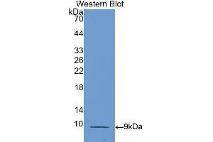 Western blot analysis of the recombinant protein. (CCL5 antibody  (AA 24-91))