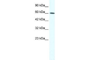 WB Suggested Anti-IRX1 Antibody Titration:  1.